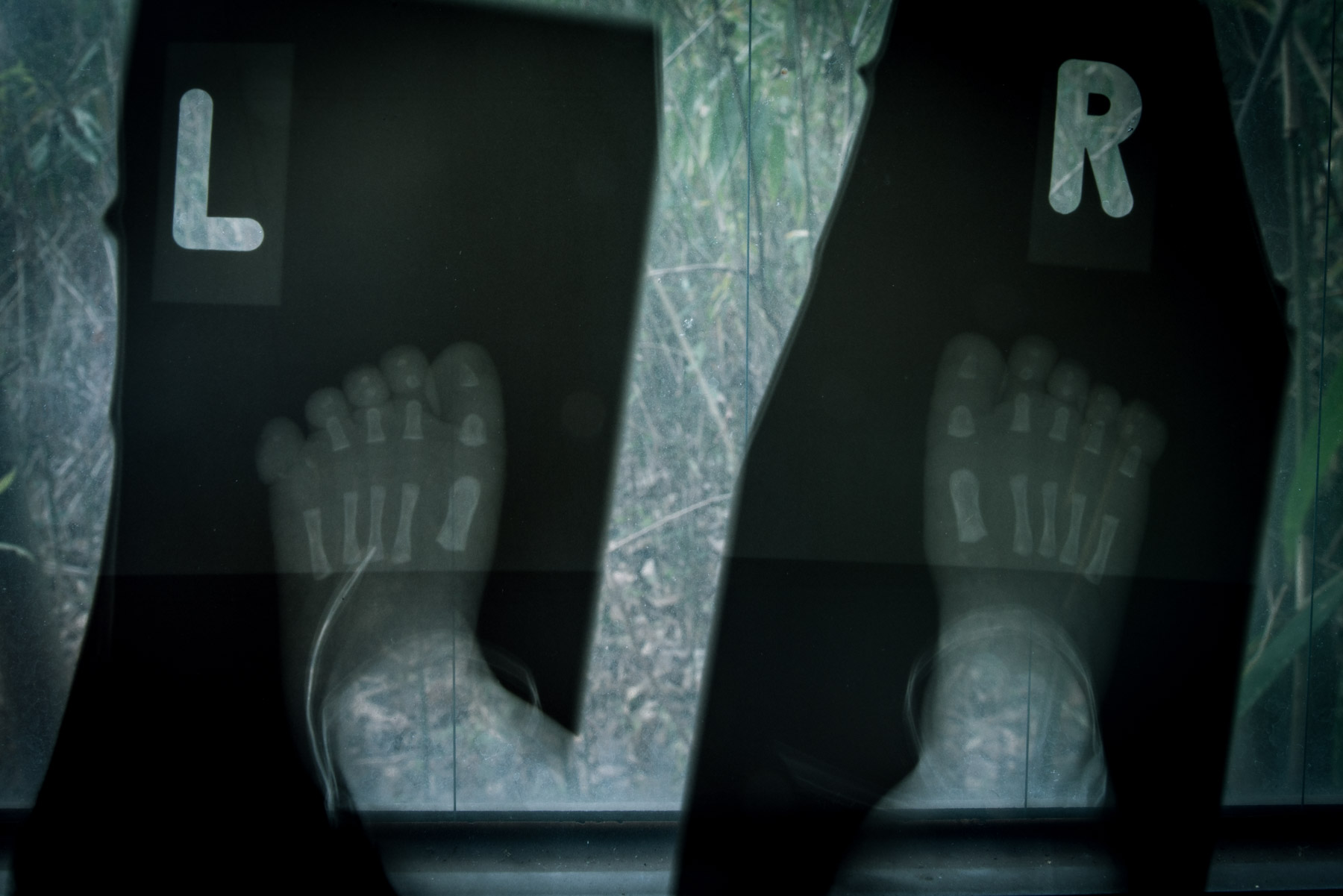 abandoned, haikyo, hospital, hyogo, japan, japanese, kansai, osaka, ruin, urban exploration, urbex