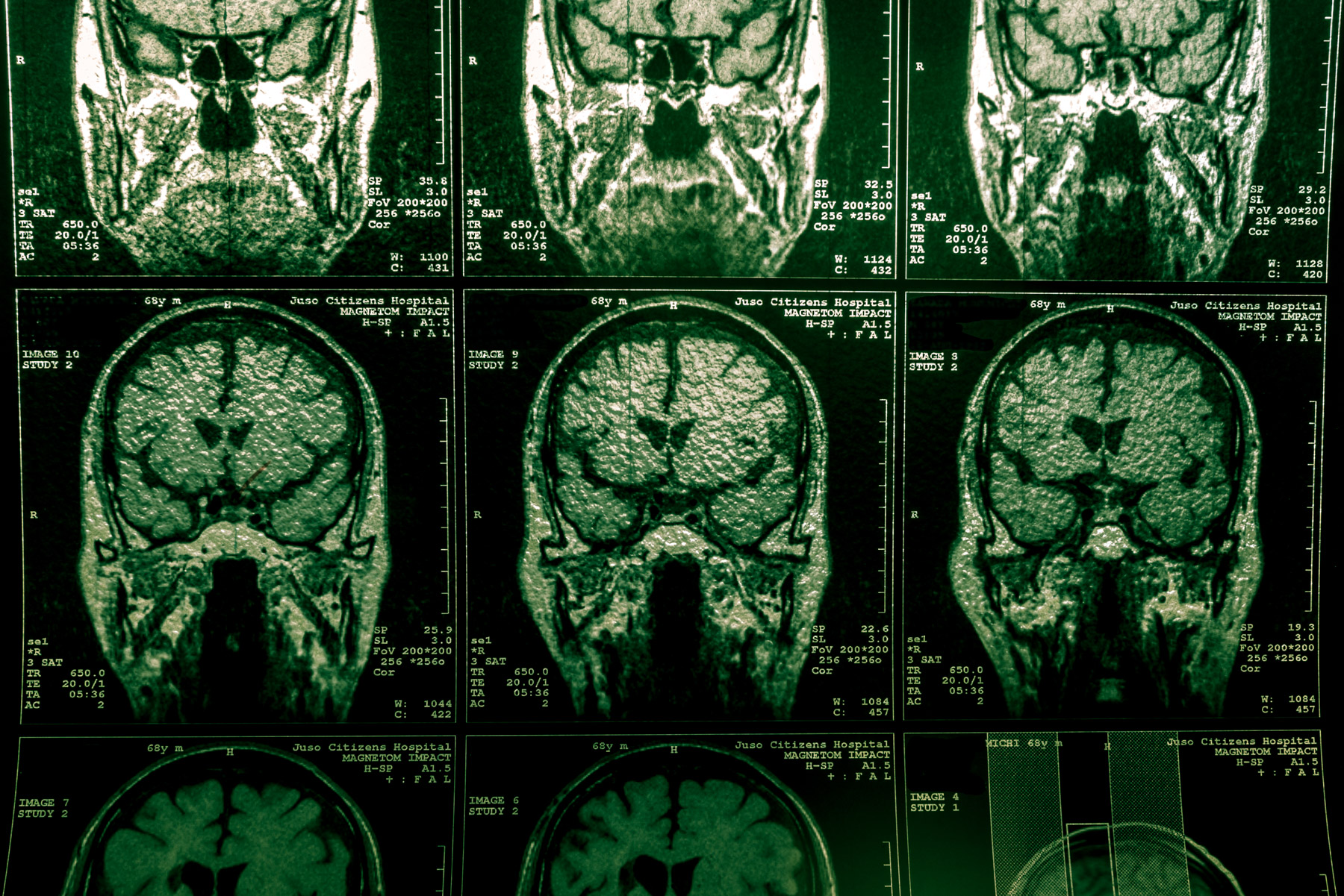 abandoned, haikyo, hospital, hyogo, japan, japanese, kansai, osaka, ruin, urban exploration, urbex